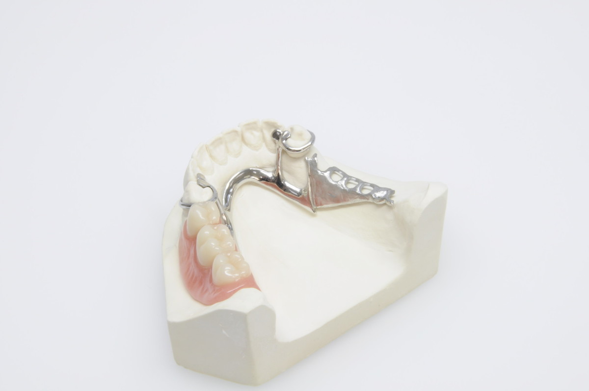 Partial dentures - complete prosthetic replacement for partly or completely toothless jaw – advanced