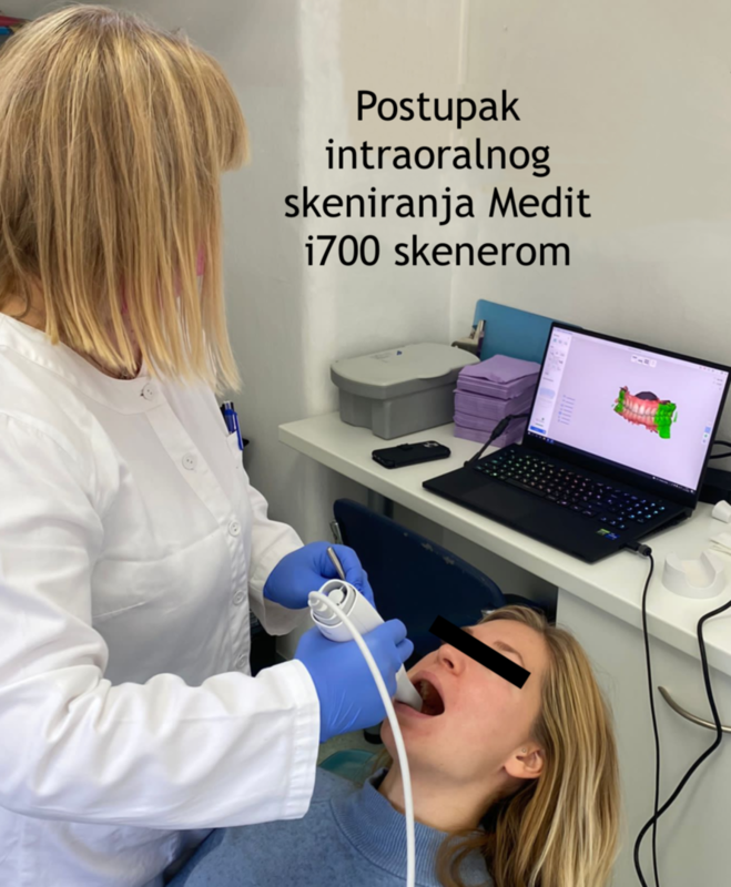 Klinička digitalna komunikacija s dentalnim laboratorijem - protokol intraoralnega skeniranja, dizajniranja i printanja - live patient demo