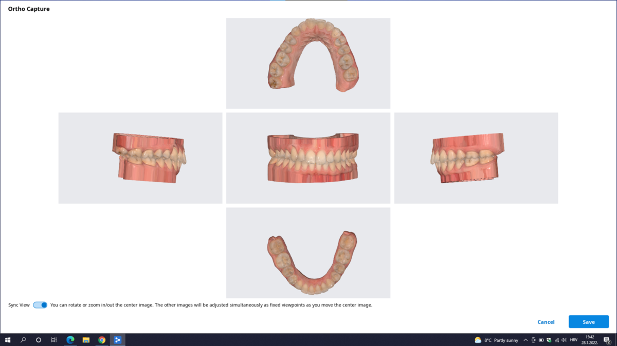 Klinička digitalna komunikacija s dentalnim laboratorijem - protokol intraoralnega skeniranja, dizajniranja i printanja - live patient demo