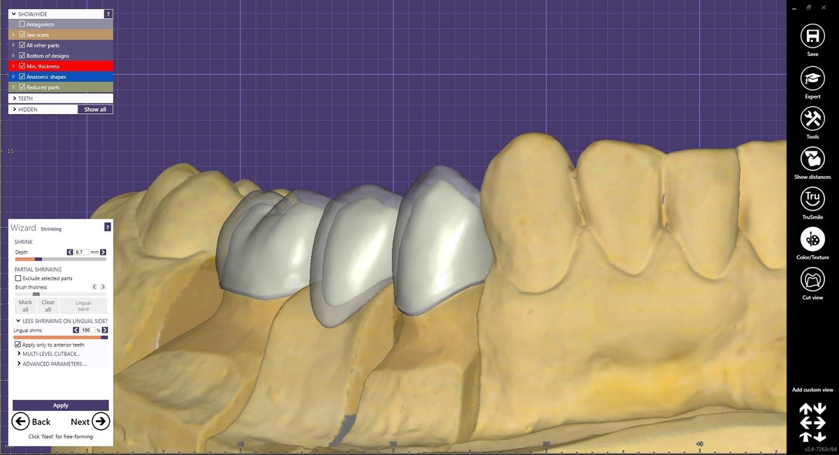 BEOGRAD - EXOCAD – DentalCAD