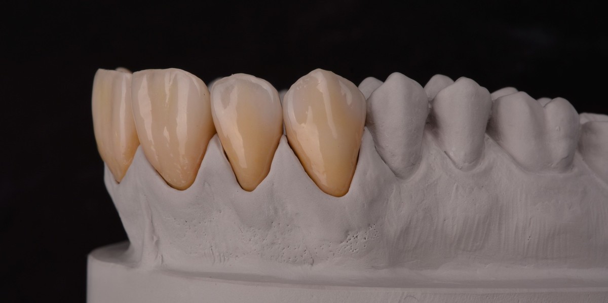 SUMMER DENTAL SCHOOL - Za mlade tehničare i učenike završne godine.