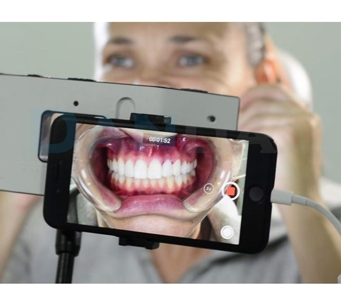 Tečaj dentalne fotografije sa pametnim telefonom te SmileLite MDP